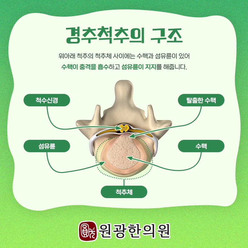 목디스크로 심해지는 경추신경 압박과 관리 방향 살펴보기