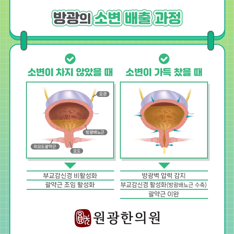 자신도 모르게 발생하는 소변 누출, 요실금 이해하기