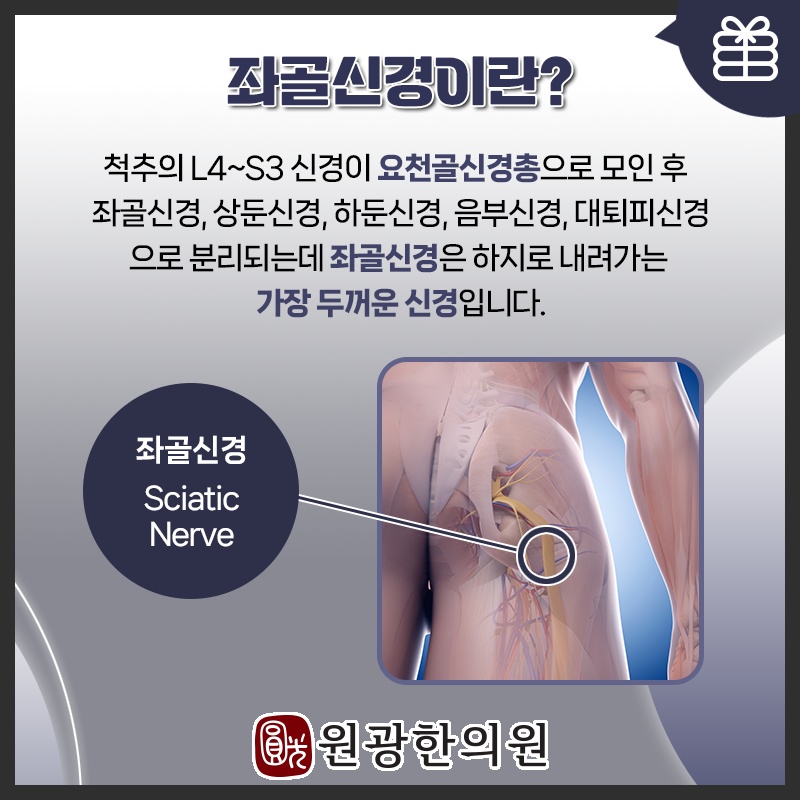 무릎 아래로 이어지는 좌골신경통 통증의 특징