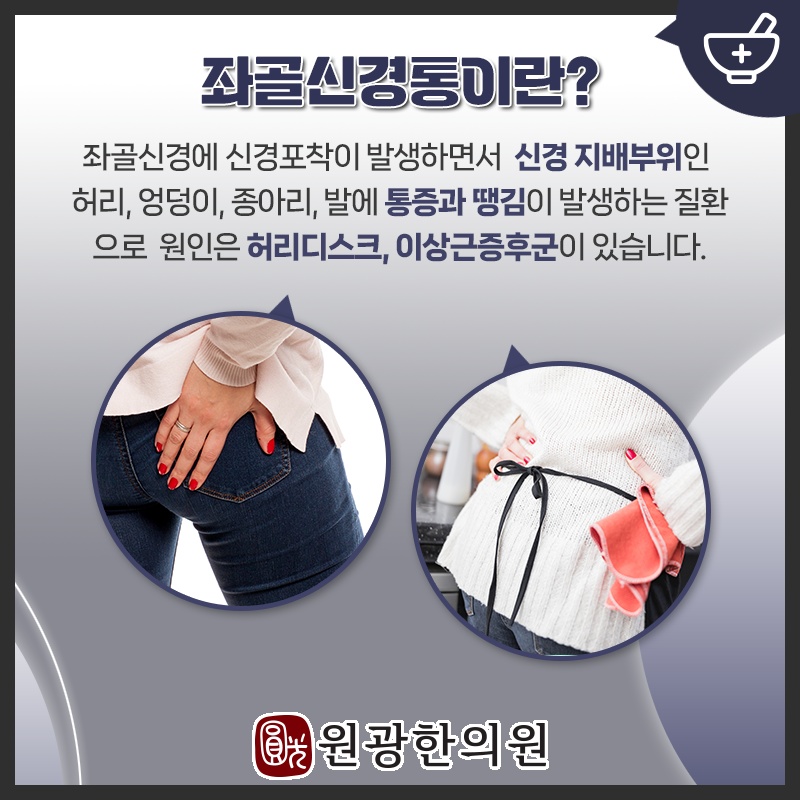 무릎 아래로 이어지는 좌골신경통 통증의 특징