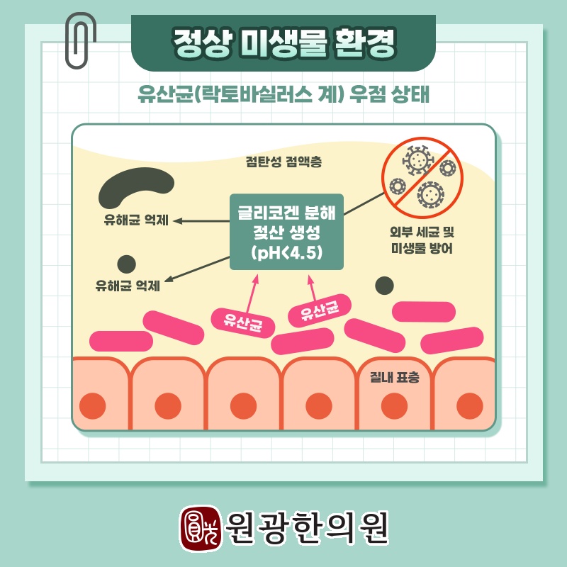 질염을 확인한 뒤 살펴야 할 증상과 생활 변화